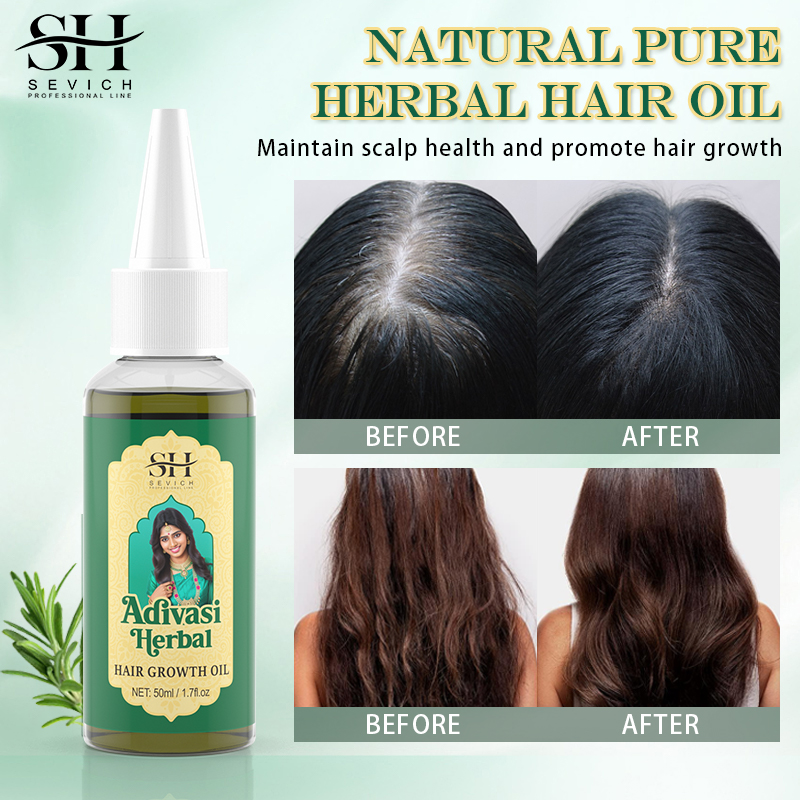 Ayurvedic Hair Growth Oil Adiv - Coconut Oil Refined review and price
